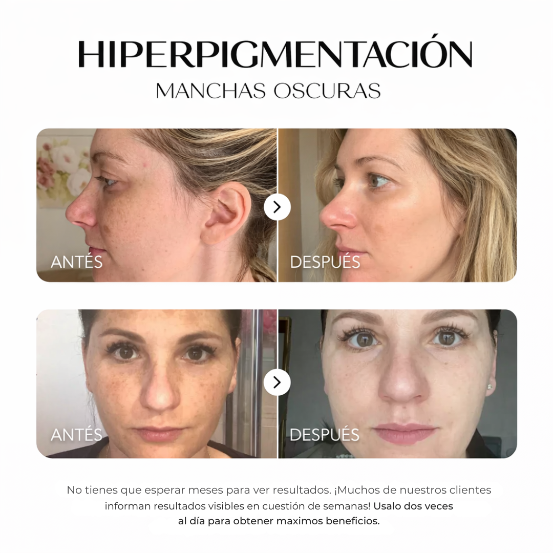 ZZENIX® - CORRECTOR DE MANCHAS