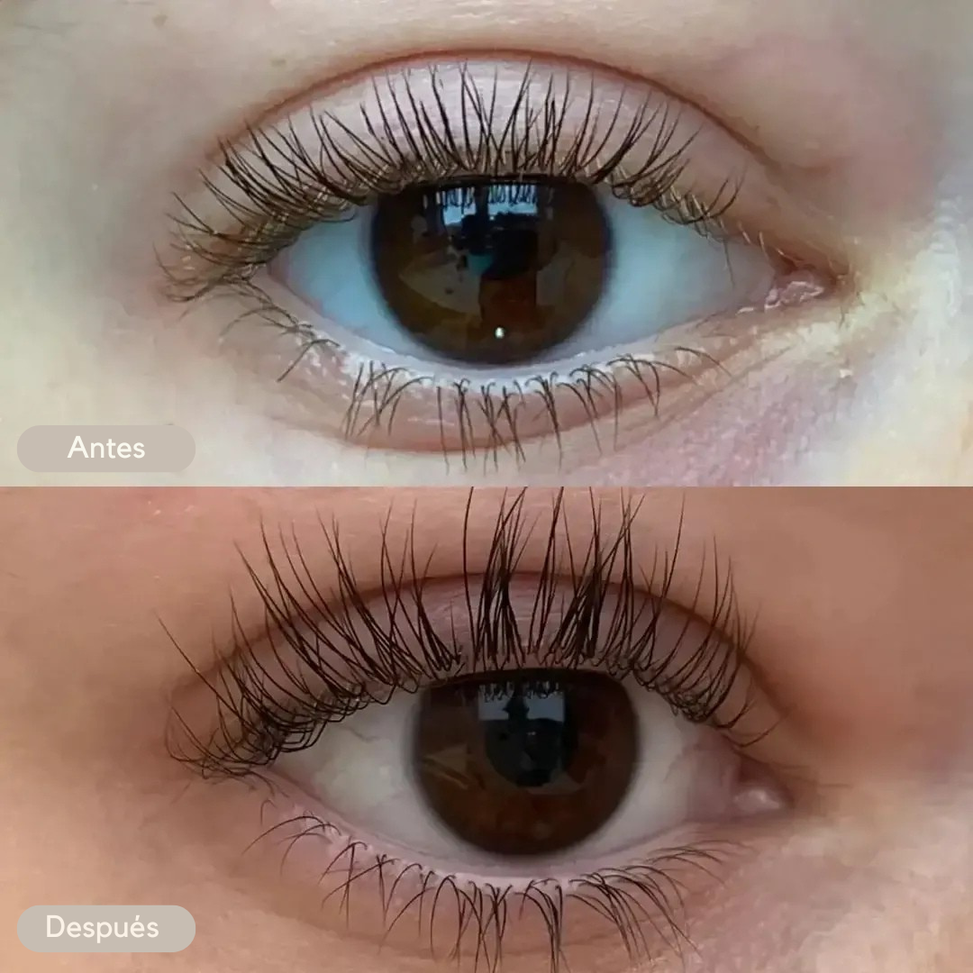 ZZENIX® - EYELASH GROWTH SERUM