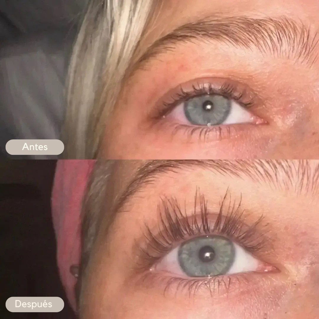 ZZENIX® - EYELASH GROWTH SERUM