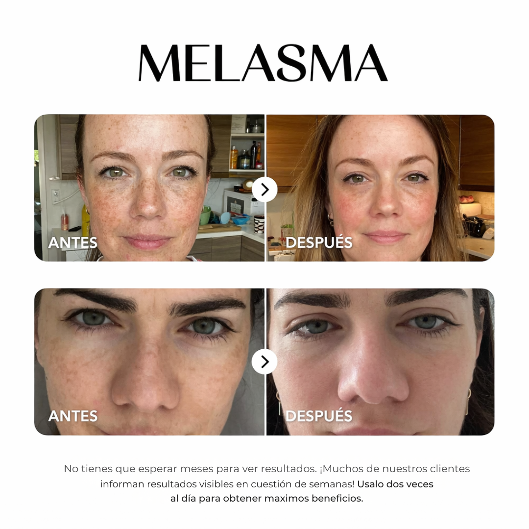 ZZENIX® - CORRECTOR DE MANCHAS