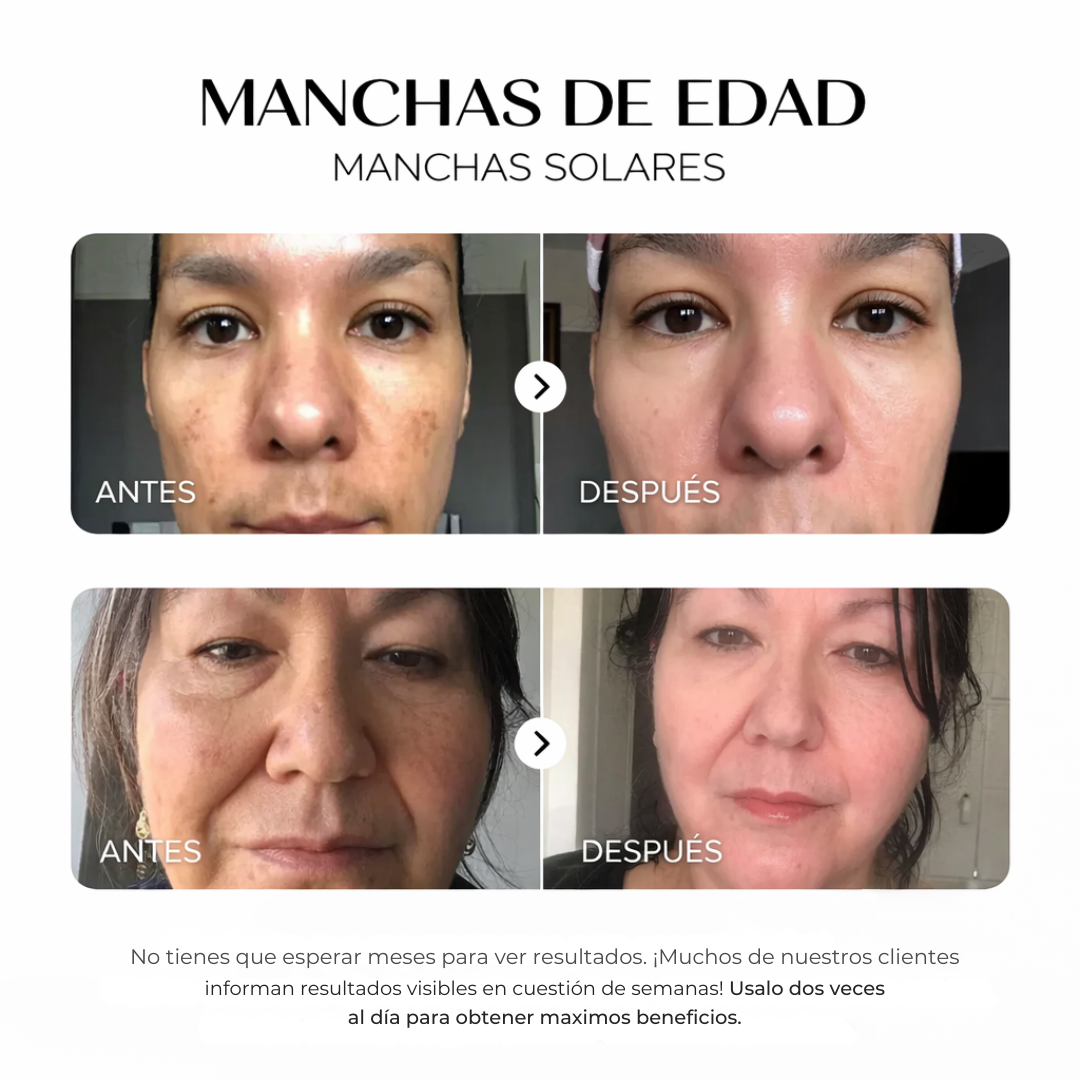 ZZENIX® - CORRECTOR DE MANCHAS