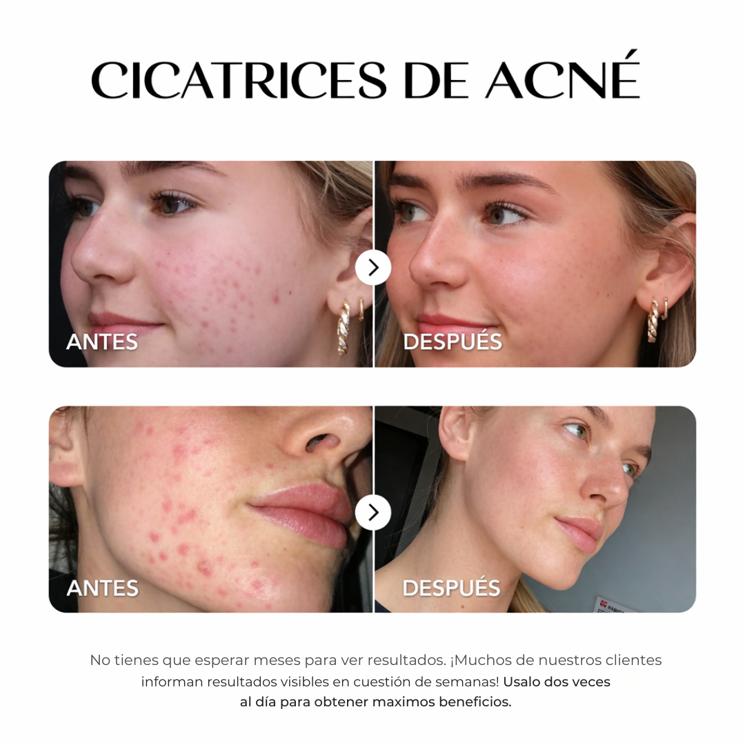 ZZENIX® - CORRECTOR DE MANCHAS