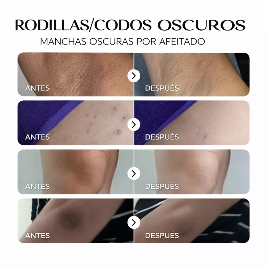 ZZENIX® - CORRECTOR DE MANCHAS