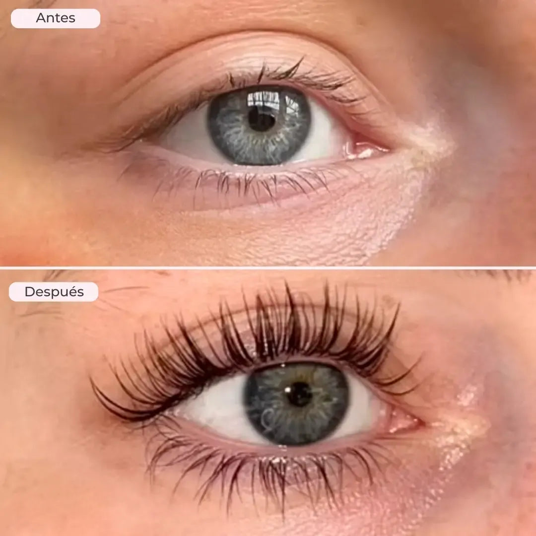 ZZENIX® - EYELASH GROWTH SERUM